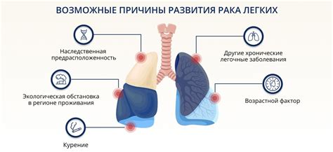 Почему нужно обращать внимание на боли в легких