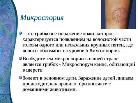 Правила и рекомендации для купания при наличии микроспории гладкой кожи: