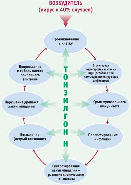 Преимущества Тонзилгона