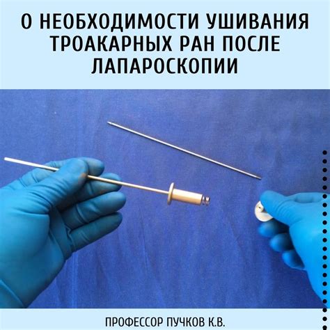 Преимущества закрытия сосков