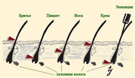 Преимущества и недостатки бритья волос на ногах у мужчин