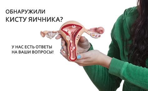 Преимущества и ограничения использования спирали при кисте яичника