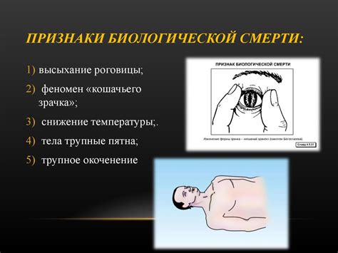 Признаки близости смерти: физические проявления умирающего организма