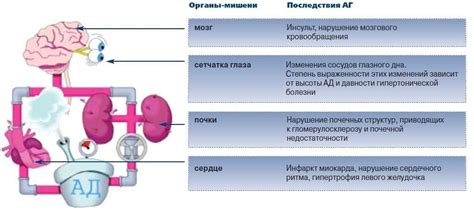 Принципы рационального труда при гипертонии 2 степени
