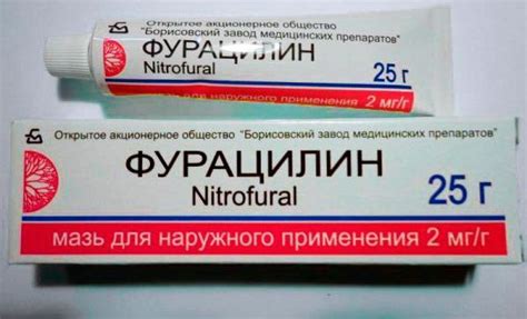 Причины возникновения ожогов от утюга