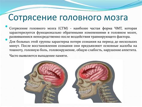 Причины и симптомы сотрясения мозга