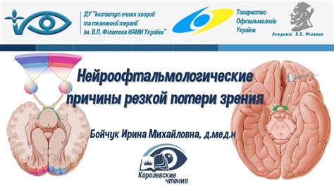 Причины потери зрения
