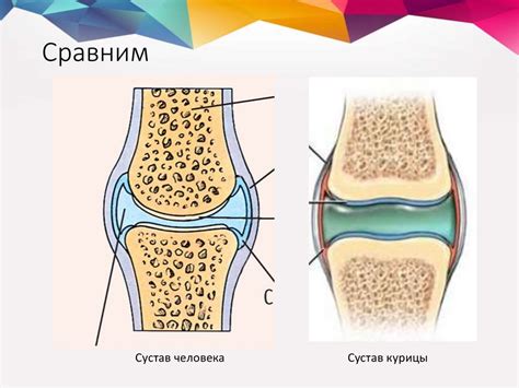 Простуда и ее влияние на суставы