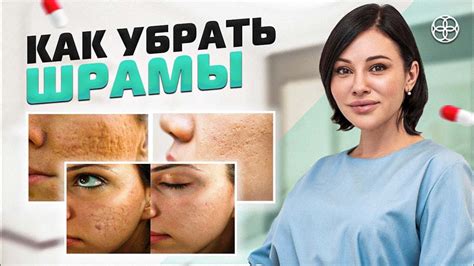 Профессиональные методы лечения и предотвращения шрамов