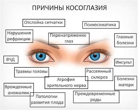 Профилактика косоглазия у детей