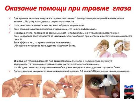 Профилактические меры для предотвращения чумы