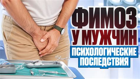 Психологические последствия измены у мужчин и их влияние на принятие решения о разводе