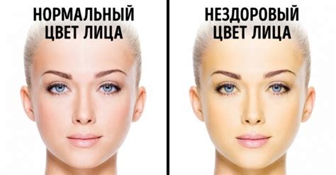 Различные факторы, влияющие на цвет лица