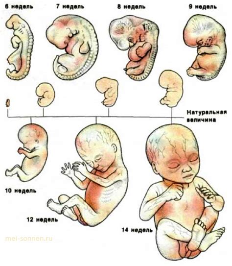 Ранние роды: ребенок на 5 месяцев беременности