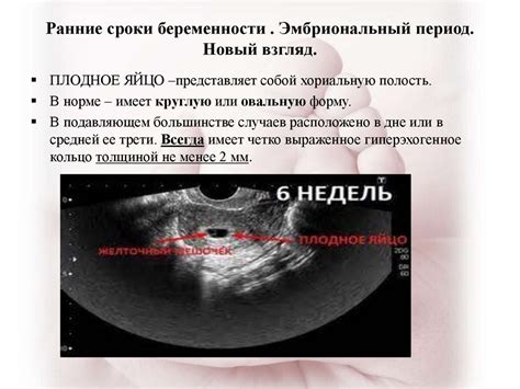 Расположение плаценты в ранних сроках беременности