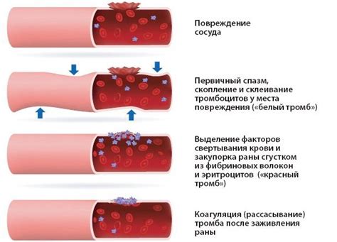 Распространенные причины изменения времени свертывания крови