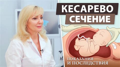 Редкие и особые случаи, когда подходит кесарево в 28 недель