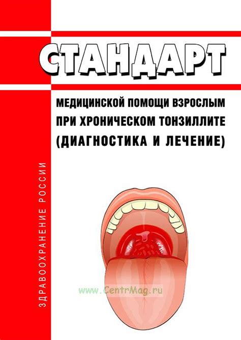 Рекомендации по питанию при хроническом тонзиллите: