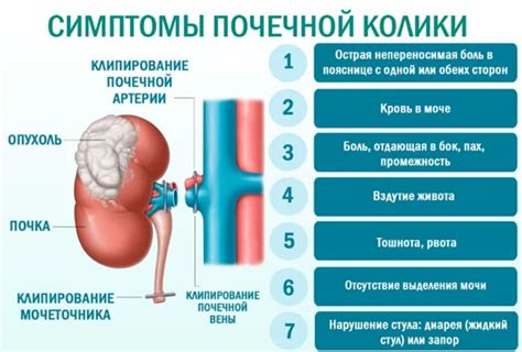 Рекомендации по употреблению жидкости при почечной колике