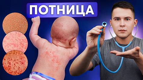 Риски применения фумигаторов у грудничков