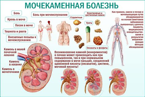 Риск использования креатина при наличии камней в почках