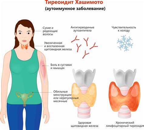 Роли щитовидной железы в женском репродуктивном системе
