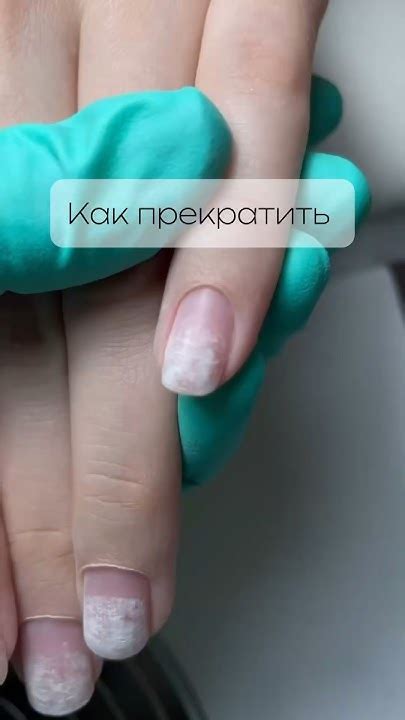 Сильное сморкание: важность бережного отношения к носу