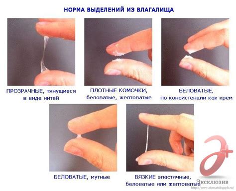 Симптомы желтых выделений после родов