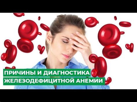 Симптомы и проявления анемии