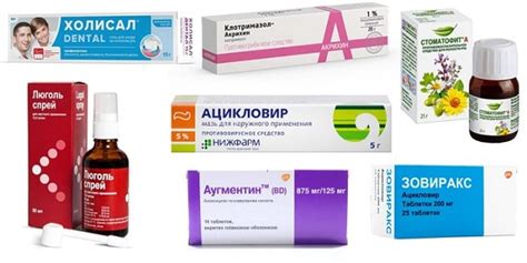Следует ли купаться при стоматите у детей: мнение врачей