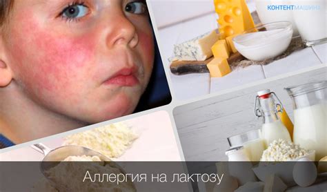 Советы для родителей, чей ребенок страдает от аллергии на яйцо