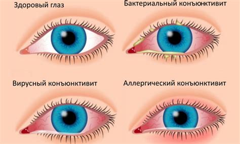 Советы по выбору качественных капель от течки