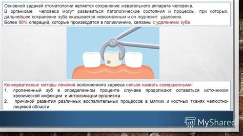 Сохранение зуба
