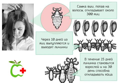 Способы передачи вшей от человека к человеку