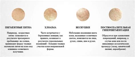 Типы пятен и выбор метода отмывания