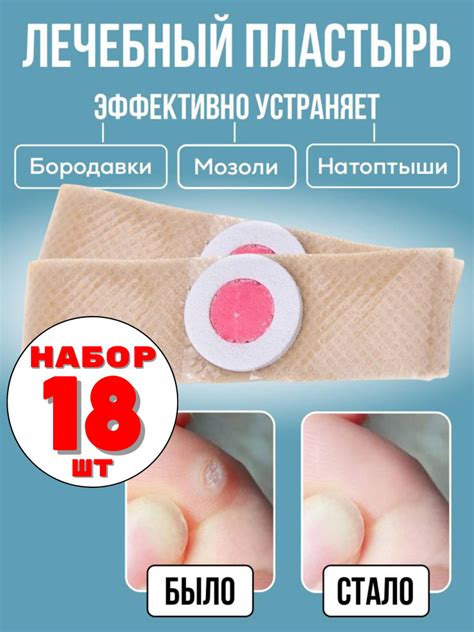 Трудности при удалении хны