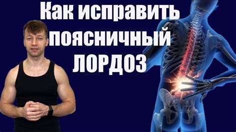 Упражнения для исправления лордоза