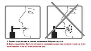 Целование при стоматите: правила и рекомендации