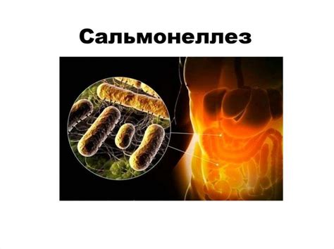 Что такое сальмонеллез: причины и симптомы