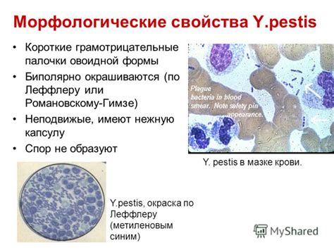Чума: историческое заболевание и его современная форма