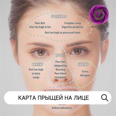 Эффективность прижигания прыщей на лице чистотелом: реальные результаты