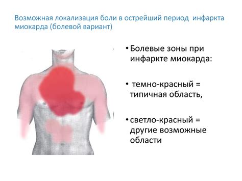  Методы лечения хондроза и устранение болей в грудной клетке 